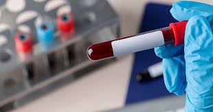 Viremia residual del VIH: por qué el virus persiste en algunos pacientes, según científicos de Harvard y el MIT