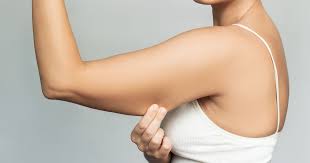 Cómo eliminar el famoso “salero”, la grasa ubicada en la parte posterior del brazo