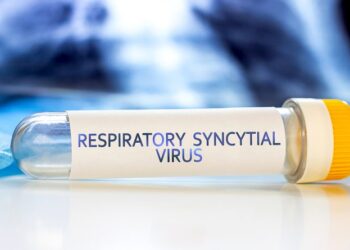 Virus sincicial respiratorio: 200 casos positivos en pacientes hospitalizados