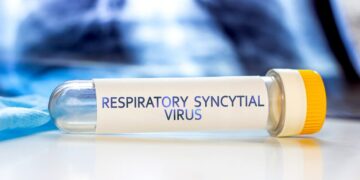 Virus sincicial respiratorio: 200 casos positivos en pacientes hospitalizados